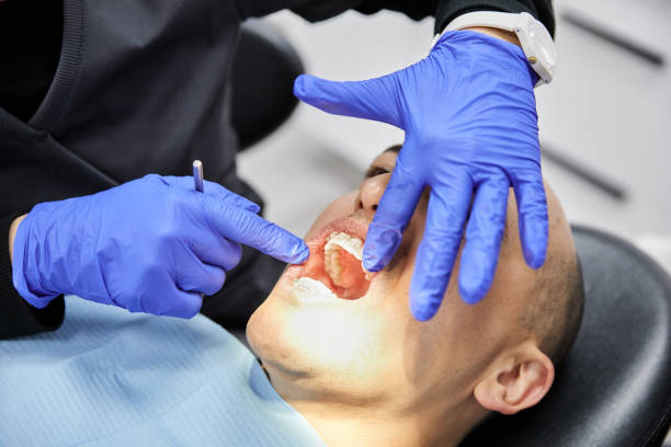 Best Broken or Chipped Tooth Repair in Ofallon, MO